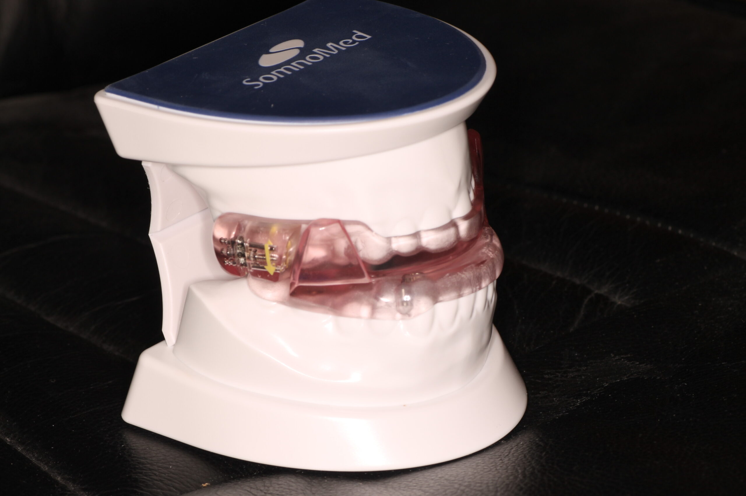 SomnoMed Oral Appliance Model
